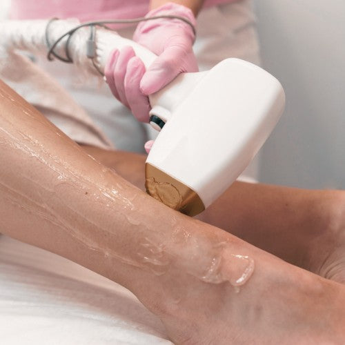 Laser Hair Removal