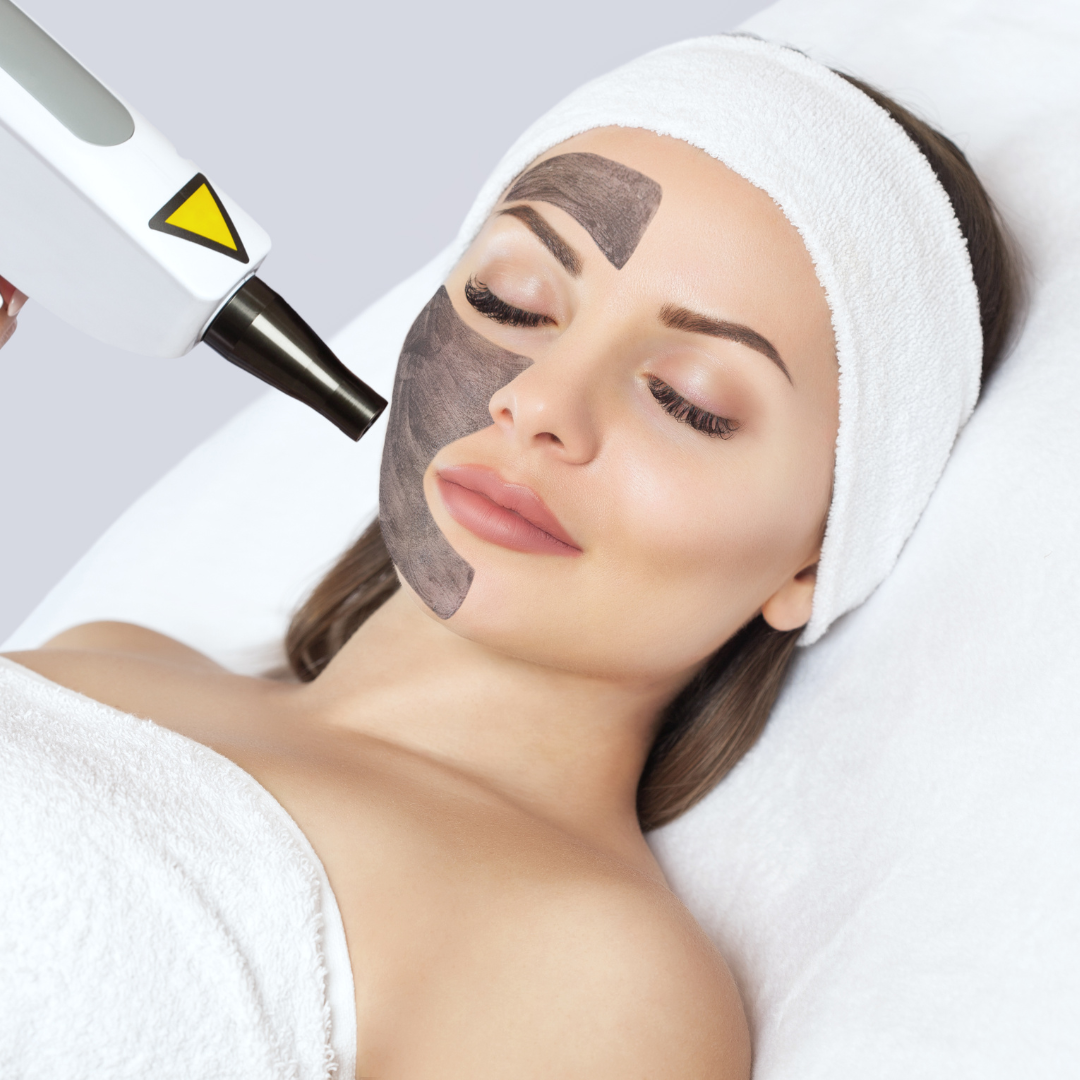 Hollywood Carbon Laser Peel Facial