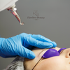 Brow Tattoo Removal