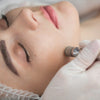 Microdermabrasion