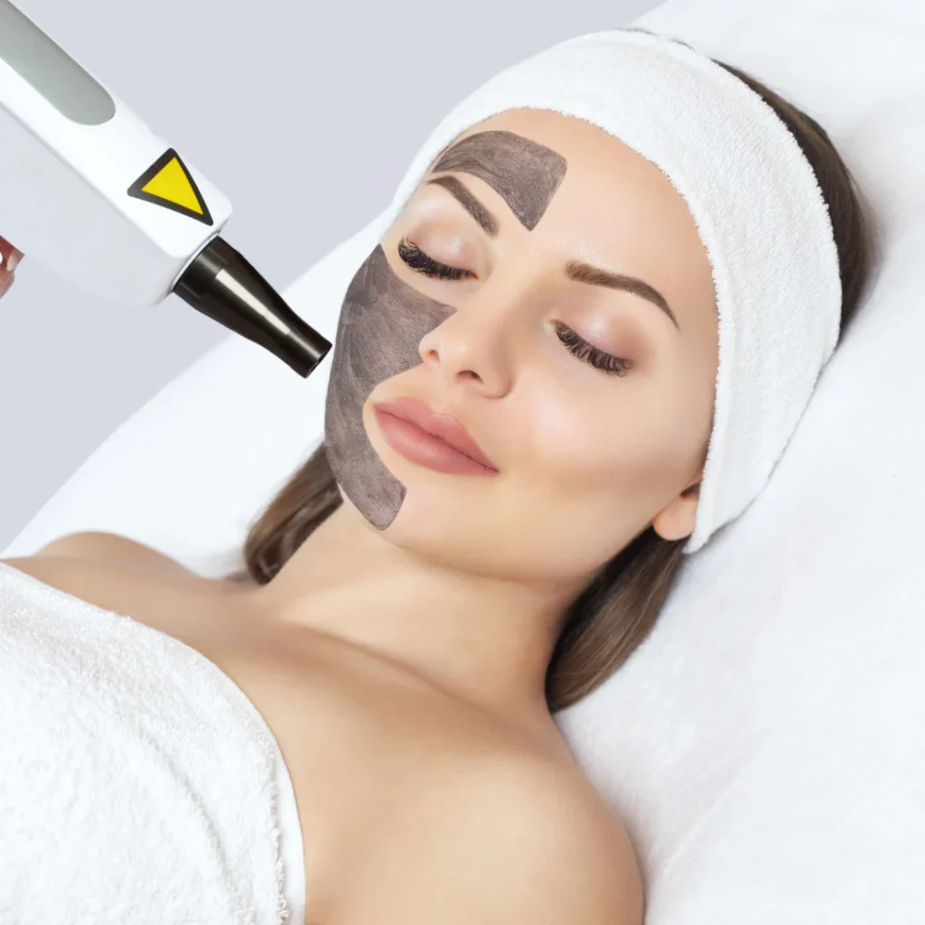 Hollywood Carbon Laser Peel Facial