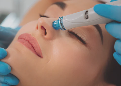 Hydrafacial Treatment Hewlett